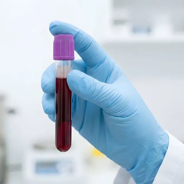 Functional Psychiatry lab testing tubes